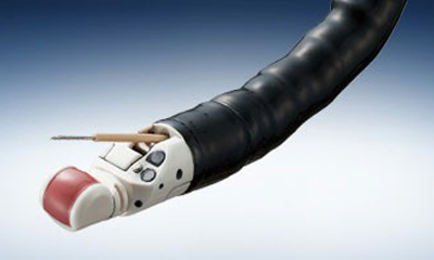 Ultrasound Guided Needle Aspiration