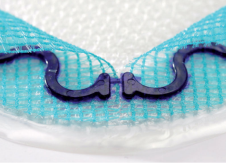 Parietex™ Composite Ventral Patch