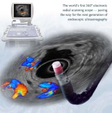 Radial Scanning Ultrasound Endoscope GF-UE160-AL5
