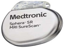 Single Chamber Pacemaker