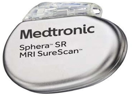 Single Chamber Pacemaker