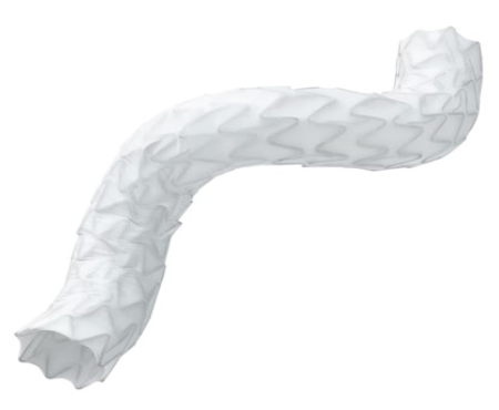 Radiant™ Balloon Expandable Covered Stent