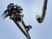 Gastroscopes