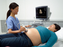 ACUSON S1000 Ultrasound System 