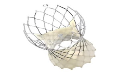 Transcatheter Aortic Valve Implantation (TAVI)