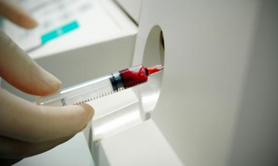 Point of Care Testing