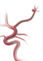 Micro Catheters