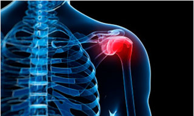 Orthopedic