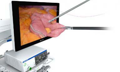 Laparoscopy and Thoracoscopy Equipment