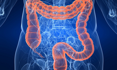 Colonoscopy