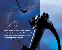 Actera Video Gastrointestinal Scope GIF-XP150N