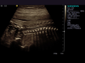 ACUSON S2000 Ultrasound System