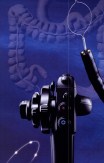 Actera Video Colonoscope CF-Q150