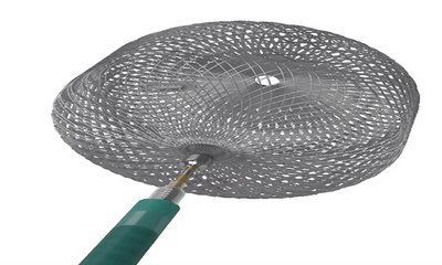 Intrasaccular Device