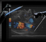 Linear Echoendoscope GF-UC240P-AL5