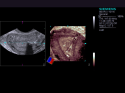 ACUSON S2000 Ultrasound System