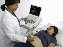 ACUSON P300 Ultrasound System 