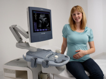 ACUSON X150 Ultrasound System 