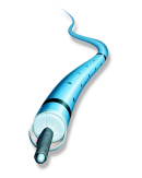 Blood Clot Therapy