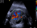ACUSON S3000 Ultrasound System