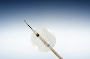 Stone Extraction Balloons