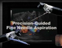 Linear Echoendoscope GF-UCT140–AL5