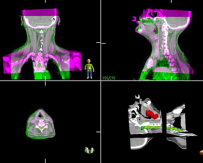 MOSAIQ® Radiation Oncology Information System