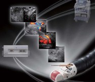 Ultrasound Gastrovideoscope TGF-UC180J