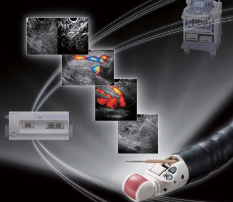 Ultrasound Gastrovideoscope TGF-UC180J